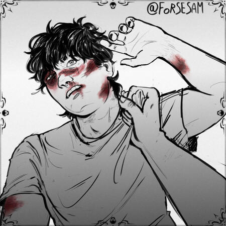 day 3 - bruise